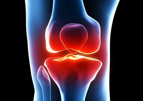 ランニングで起こる膝痛の症状