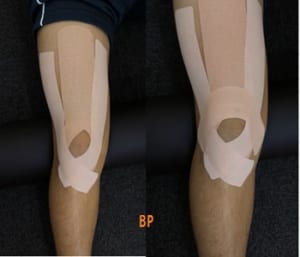 膝下の痛みは原因の多くが 使いすぎ かも 正しい対処法を動画解説 ひざ痛チャンネル