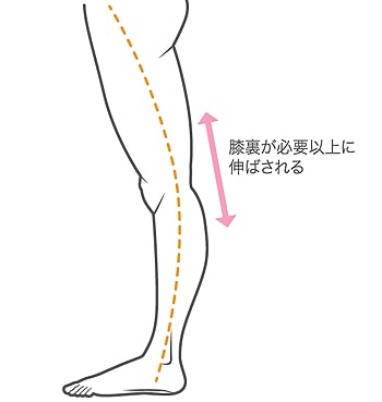 膝裏が痛い原因と対処法を医師が解説 〜実際の質問への返答も公開〜｜ひざ痛チャンネル