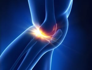 変形性膝関節症の再生医療