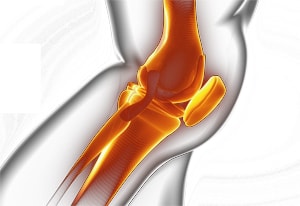 膝関節の拘縮